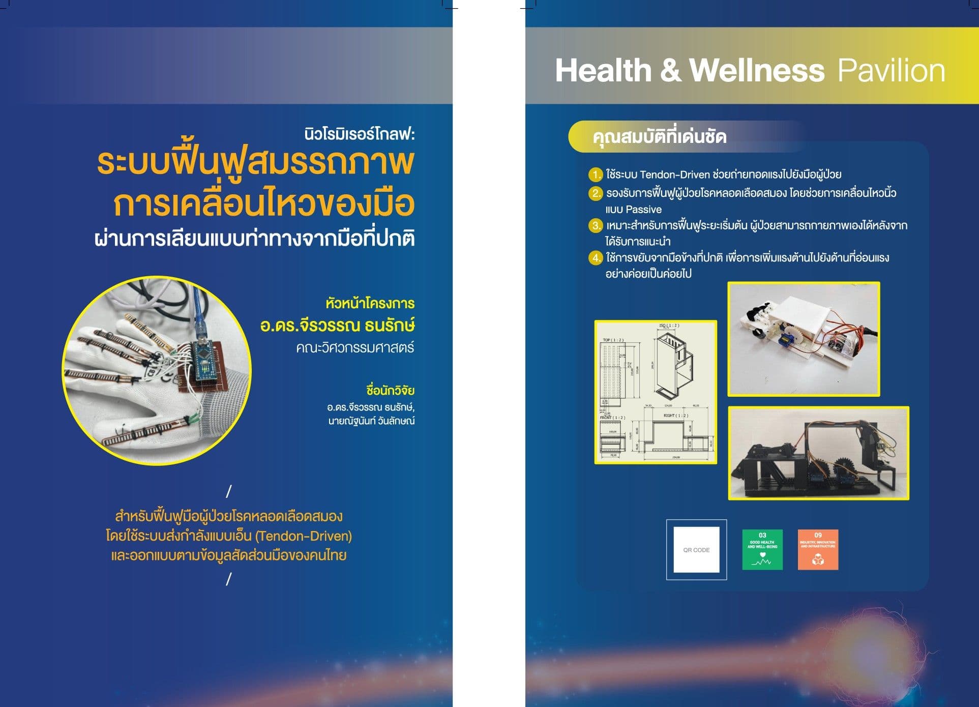 นิวโรมิเรอร์โกลฟ: ระบบฟื้นฟูสมรรถภาพการเคลื่อนไหวของมือ ผ่านการเลียนแบบท่าทางจากมือที่ปกติ