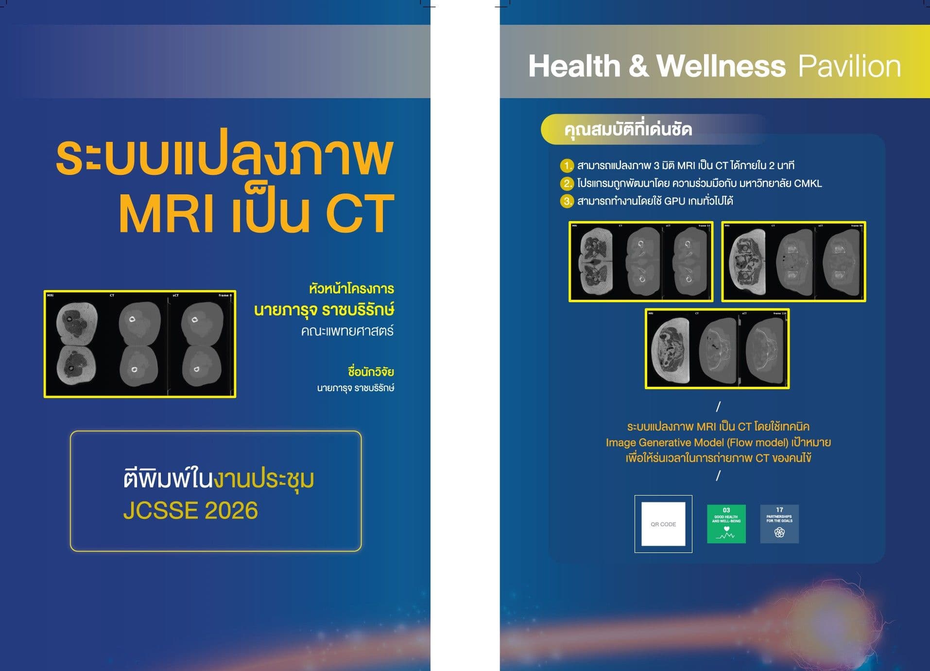 ระบบแปลงภาพ MRI เป็น CT